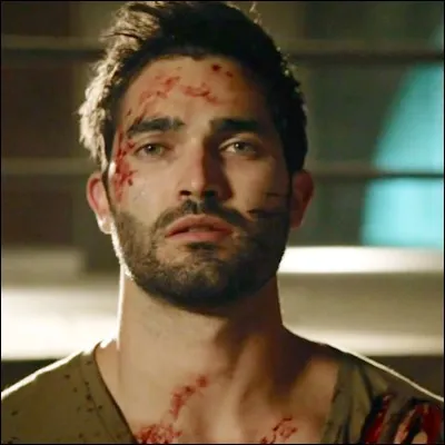 Comment Derek Hale est-il devenu un loup-garou ?