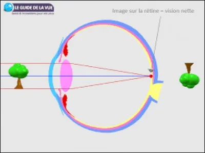 Lorsqu'un il n'a pas de défaut de vision, on dit qu'il est...