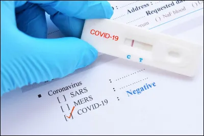 Si le nombre de décès semble élevé par rapport au nombre de cas en France, c'est parce qu'il n'est pas possible de tester tout le monde.