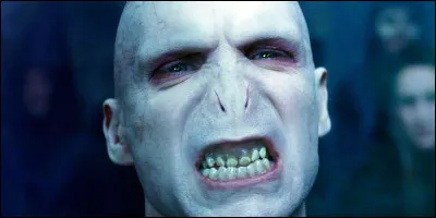 Dans la saga "Harry Potter", quel personnage endure une douleur intense à cause de visions de Voldemort ?