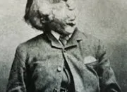 Quiz Lhistoire de Joseph Merrick