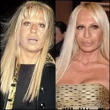 Voici Donatella Versace, laquelle a choisi de modifier en moins bien un visage pourtant plaisant. Elle a repris l'entreprise de son frre, grand couturier assassin  Miami, qui se prnommait ?