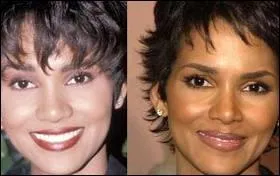 Les plus jolies stars y ont fait appel. Ici Halle Berry, qui a touch  ?