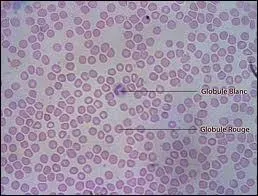 Les globules blancs sont beaucoup moins nombreux que les globules rouges.