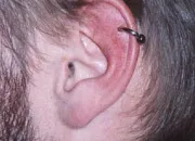 Quiz Piercing