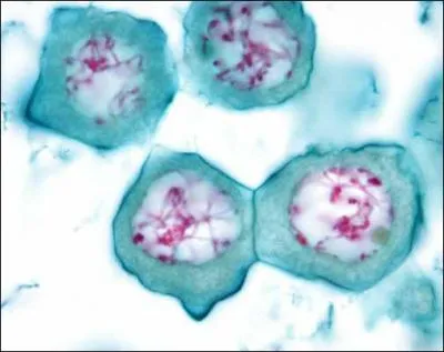 Quelles sont dans l'ordre les 5 différentes phases de la prophase ?