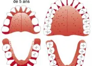 Quiz Les dents