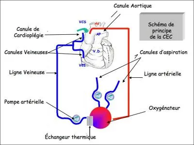 Le terme "CEC" signifie :