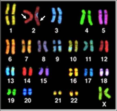 Cette photographie représente l'ensemble des chromosomes d'une cellule. Mais comment l'appelle-t-on ?