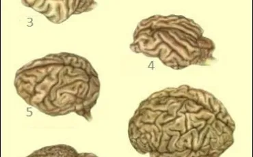 Quiz Cerveau