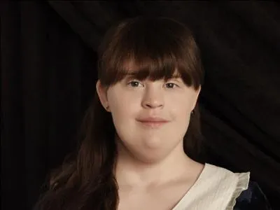 De quelle maladie est porteuse l'actrice Jamie Brewer ?