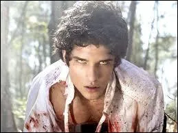 Comment s'appelle l'acteur qui interprète le mignon Scott McCall ?