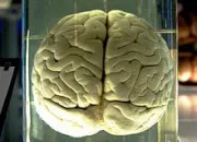 Quiz Le cerveau